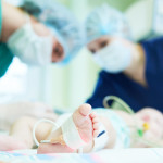 Neonatal Resuscitation. Doctor's team doing intensive therapy to newborn baby